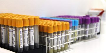 Investimentos em Exames laboratoriais